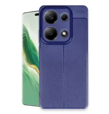 Xiaomi Redmi Note 13 Pro 4G Kılıf Auto Focus Kapak - Lacivert
