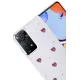 Xiaomi Redmi Note 11 Pro Fiyonk Desenli Kapak - Desen 3