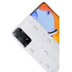 Xiaomi Redmi Note 11 Pro Fiyonk Desenli Kapak - Desen 4
