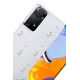 Xiaomi Redmi Note 11 Pro Fiyonk Desenli Kapak - Desen 4