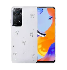 Xiaomi Redmi Note 11 Pro Fiyonk Desenli Kapak - Desen 5