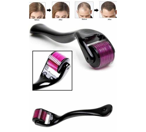 Derma Roller Titanyum Uçlu 540 İğneli 1 Mm Saç Sakal Çıkarma Ve Cilt Bakım Masaj Aleti