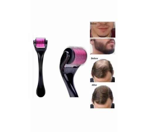 Saç Çıkarma Tarağı Dermaroller 540 Iğneli Roller 1 Mm Iğne Cilt Yüz Yenileme Bakım Seti