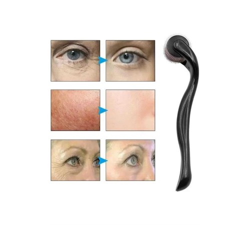 Dermaroller Titanyum 540 Iğneli 1 Mm Saç Kaş Sakal Serum Kullanıma Uygun