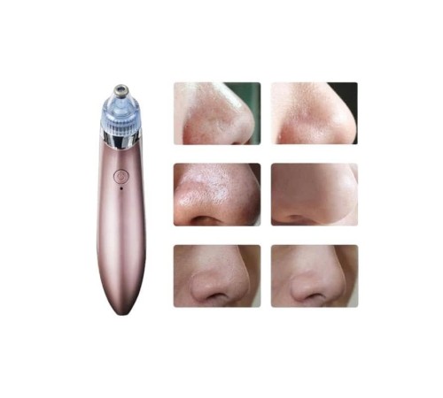 SİYAH NOKTA CİHAZI