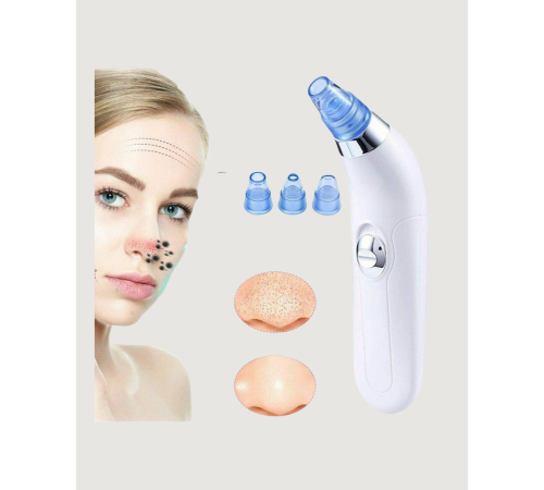 Gözenek Açıcı Buhar Etkili Vakumlu Siyah Nokta Temizleyici – Farklı Cilt Tiplerine Uygun