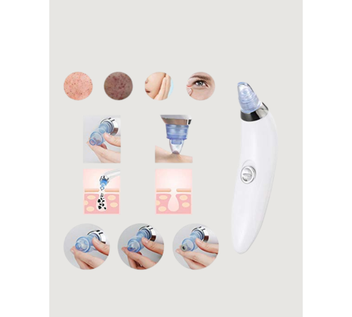 Mikro Kristal Başlıklı Siyah Nokta Temizleme Cihazı – Vakum Gücüyle Gözenek Sıkılaştırıcı