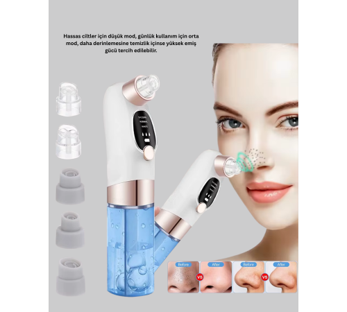 Ayarlanabilir Güç Seviyeli Vakumlu Siyah Nokta Temizleme Cihazı – Derin Gözenek Temizliği