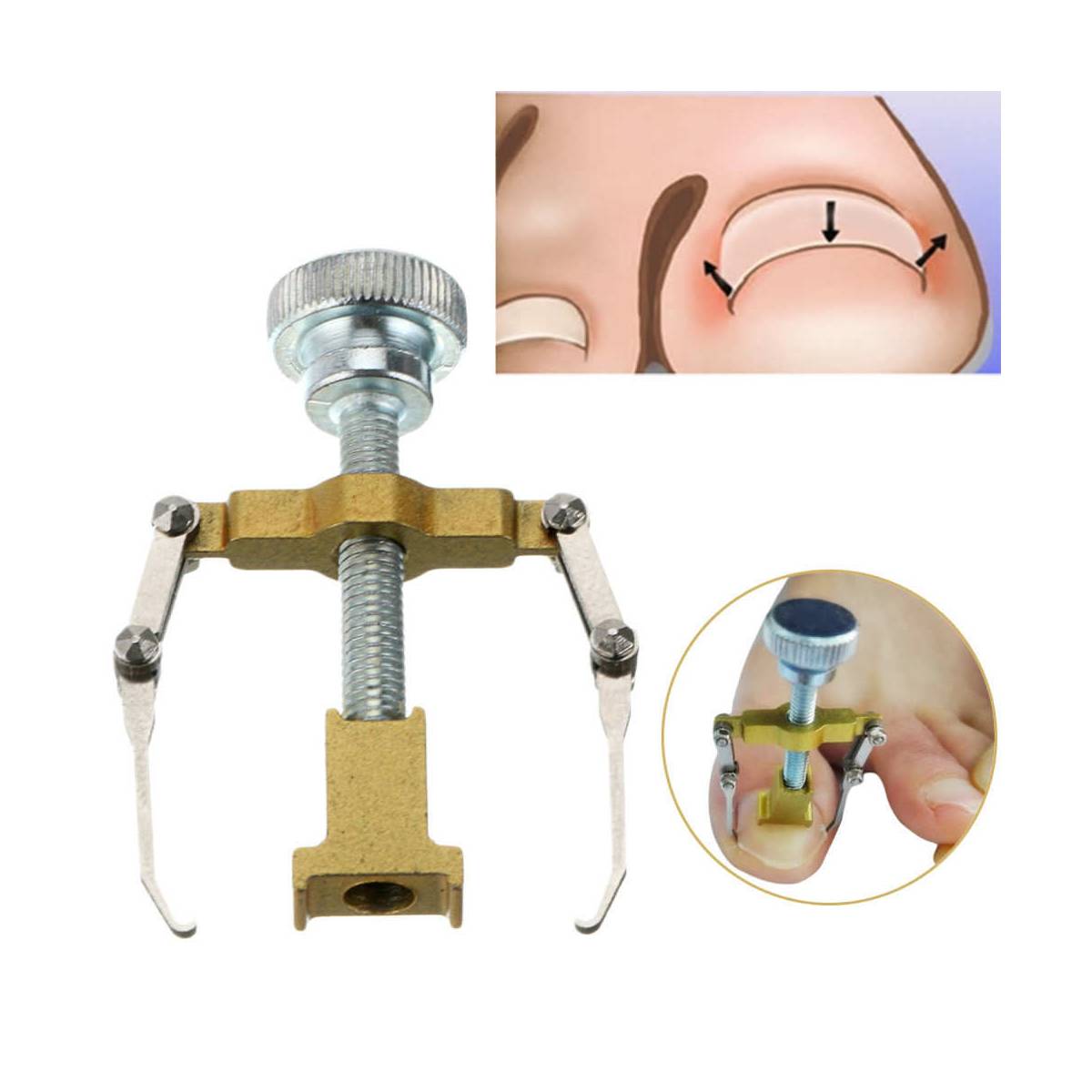 Batan Nail Fix Tool Western Nail Remover Apparatus